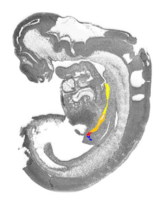 3D model of the human embryonic gastro-intestinal tract
