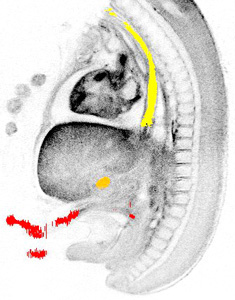 3D model of the human embryonic gastro-intestinal tract