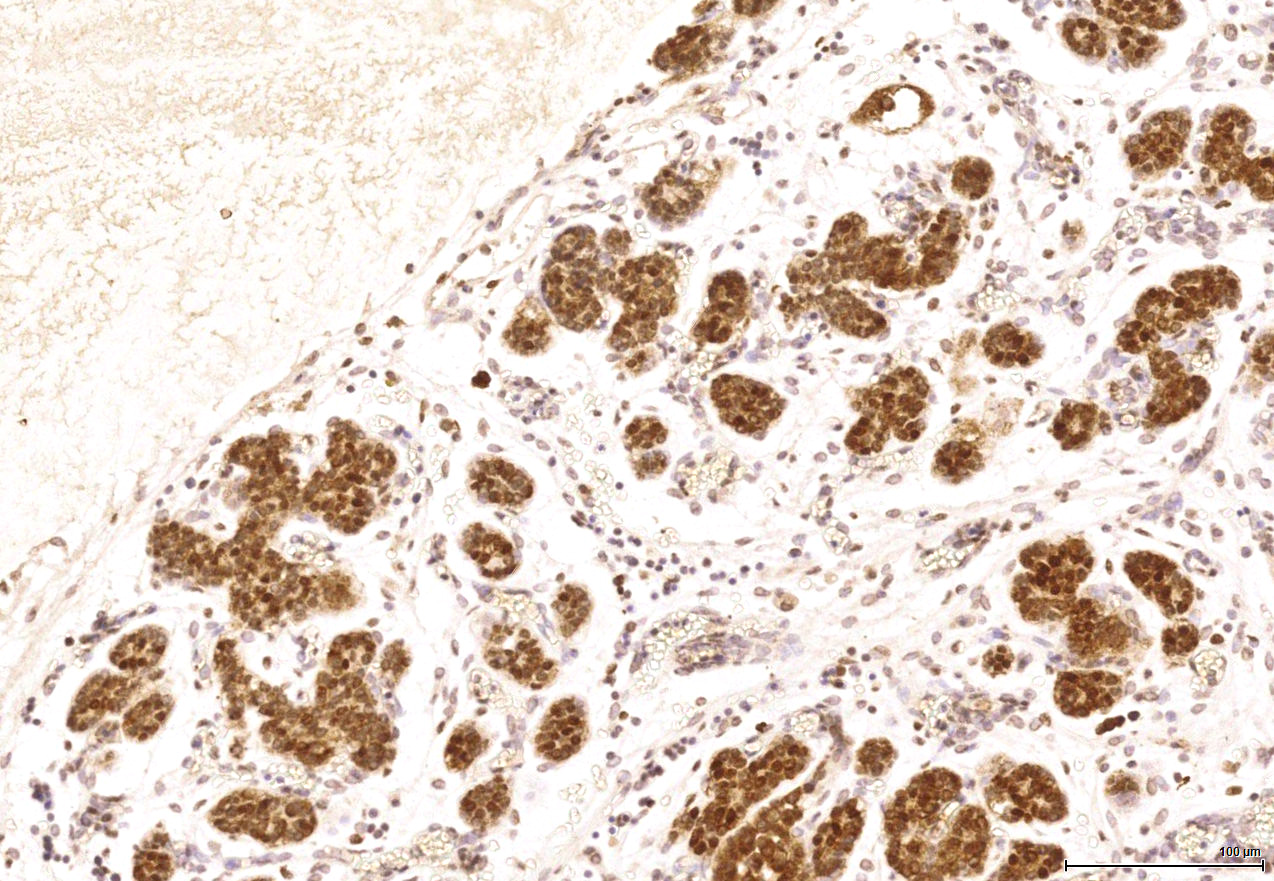 Gene expression in the human fetal pancreas
