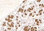 Gene expression in the human fetal pancreas