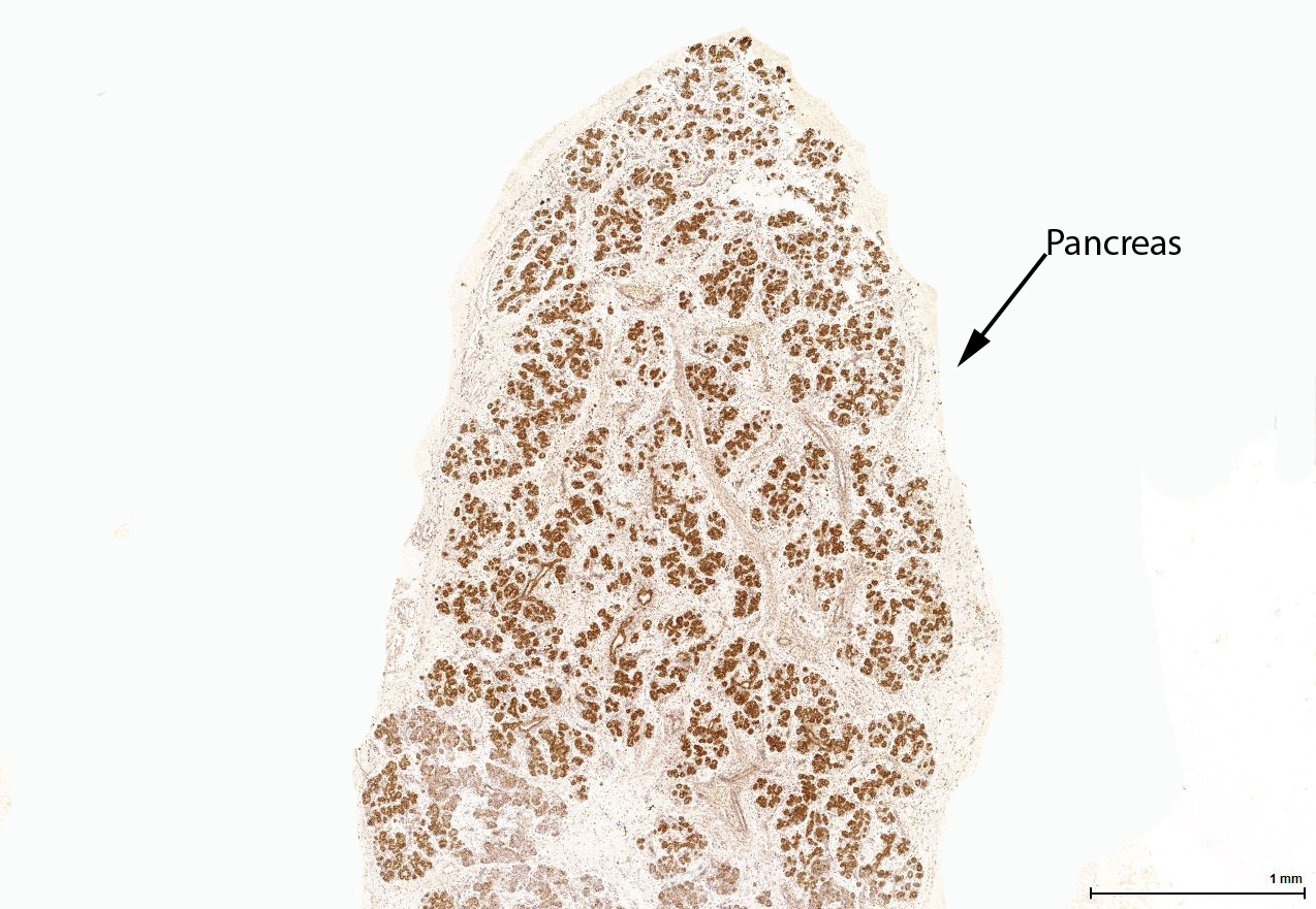 Gene expression in the human fetal pancreas