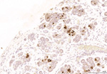 Gene expression in the human fetal pancreas