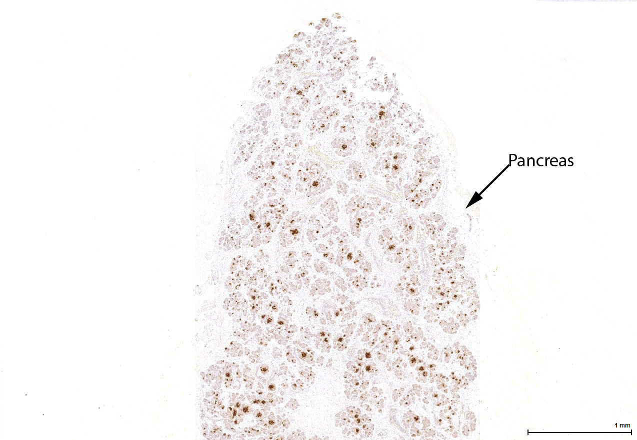 Gene expression in the human fetal pancreas