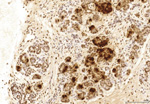 Gene expression in the human fetal pancreas