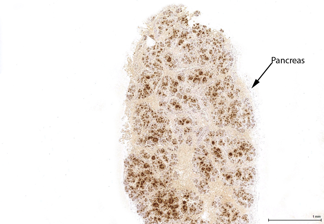 Gene expression in the human fetal pancreas