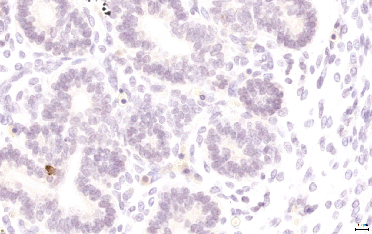 Gene expression in the human fetal pancreas