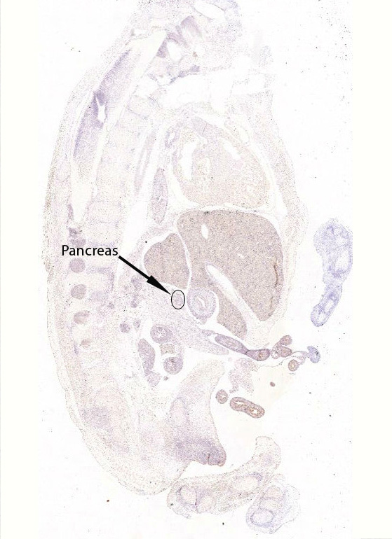 Gene expression in the human fetal pancreas
