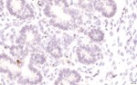 Gene expression in the human fetal pancreas