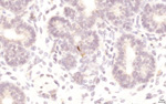 Gene expression in the human fetal pancreas