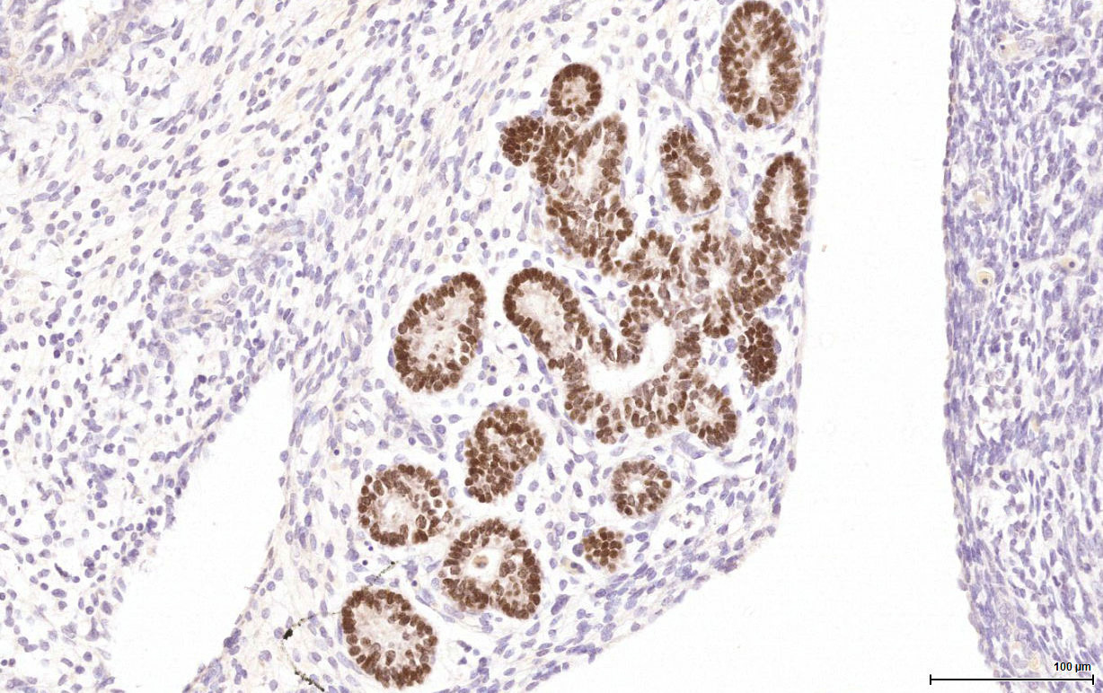 Gene expression in the human fetal pancreas