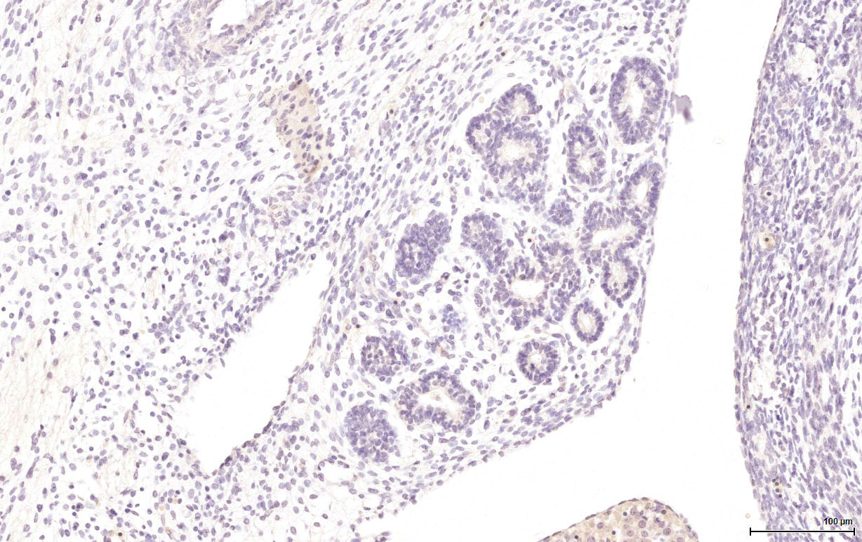Gene expression in the human fetal pancreas