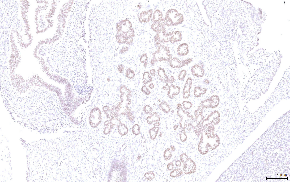 Gene expression in the human fetal pancreas