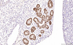 Gene expression in the human fetal pancreas