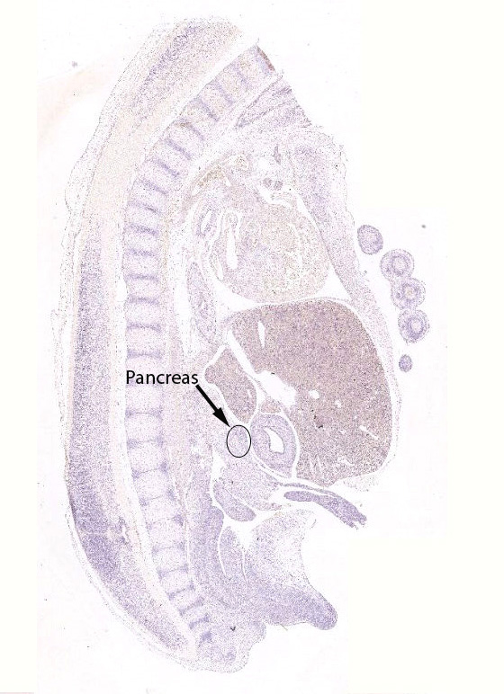 Gene expression in the human fetal pancreas