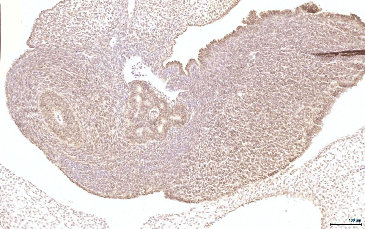Gene expression in the human fetal pancreas