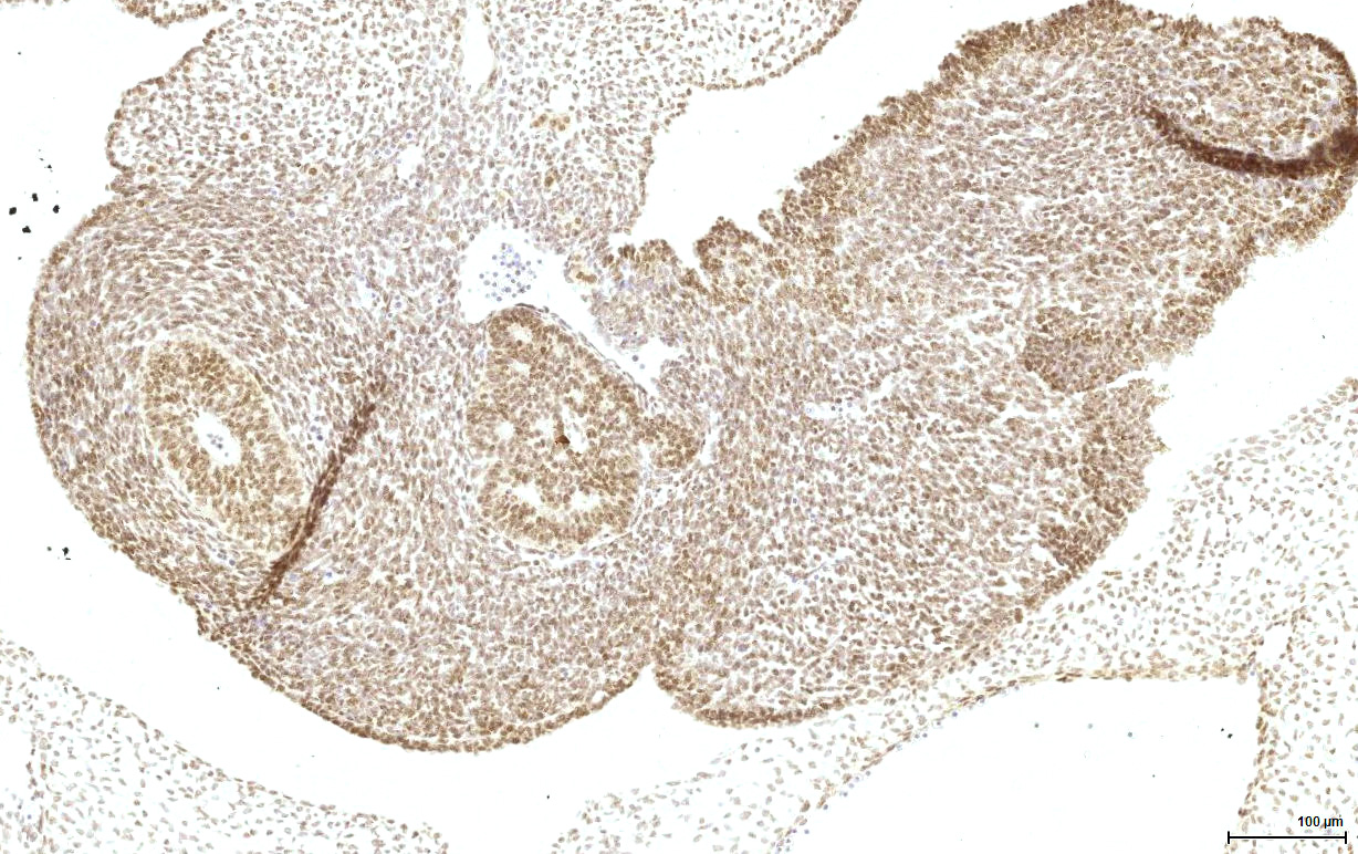 Gene expression in the human fetal pancreas