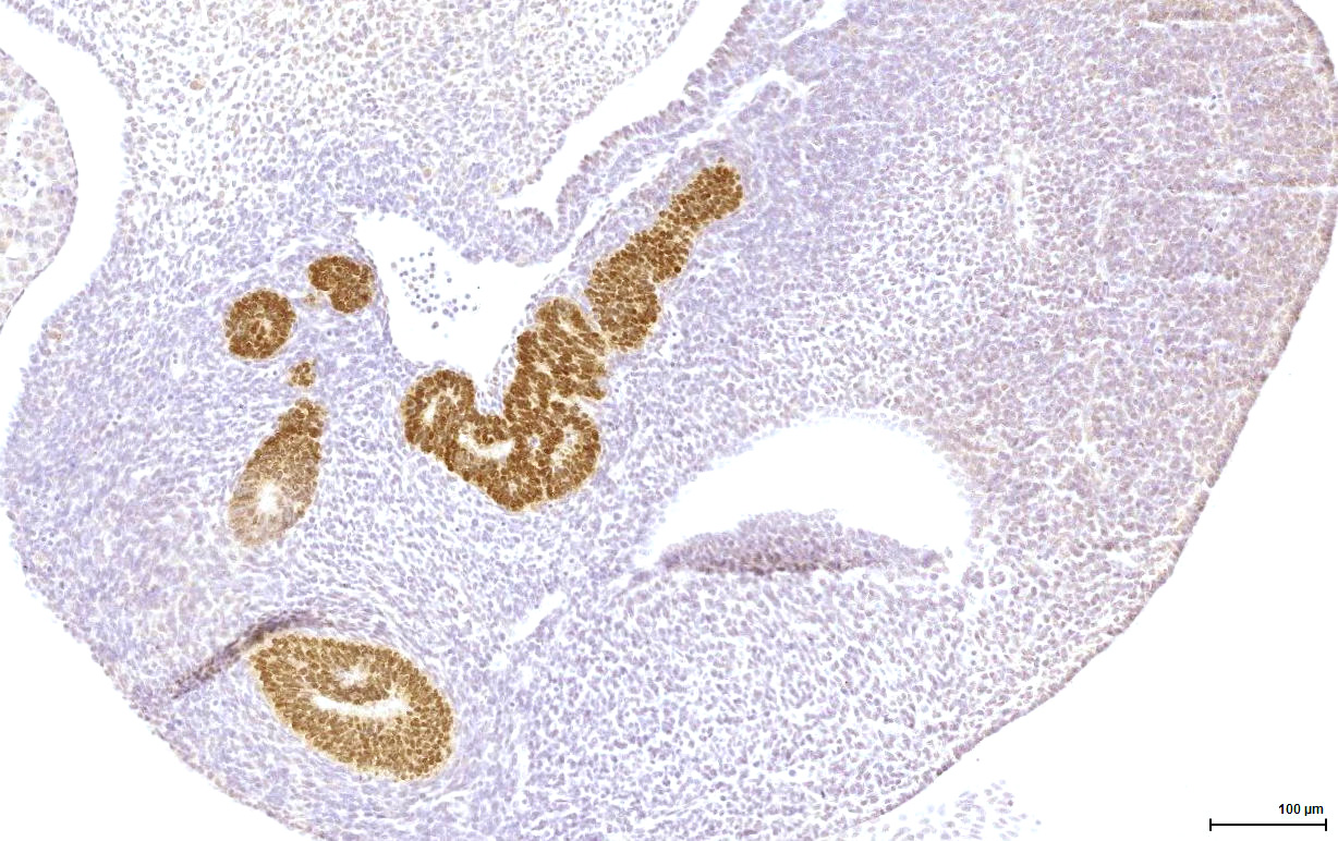 Gene expression in the human fetal pancreas