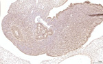 Gene expression in the human fetal pancreas