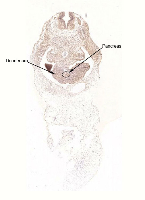 Gene expression in the human fetal pancreas