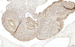 Gene expression in the human fetal pancreas