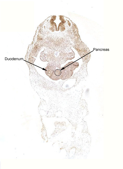 Gene expression in the human fetal pancreas