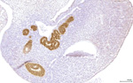Gene expression in the human fetal pancreas