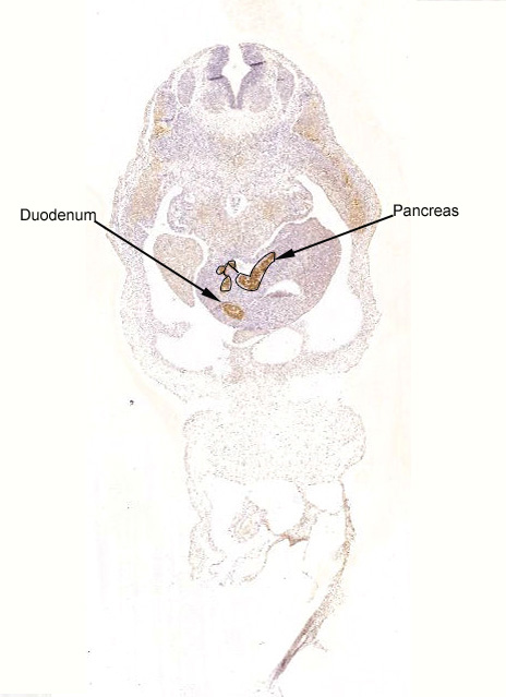 Gene expression in the human fetal pancreas