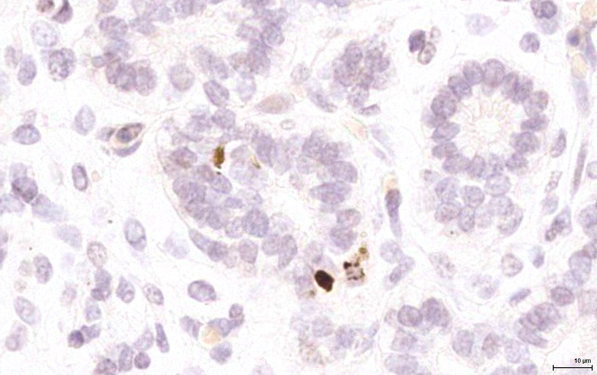 Gene expression in the human fetal pancreas