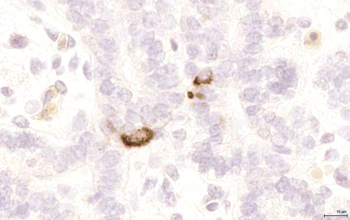 Gene expression in the human fetal pancreas