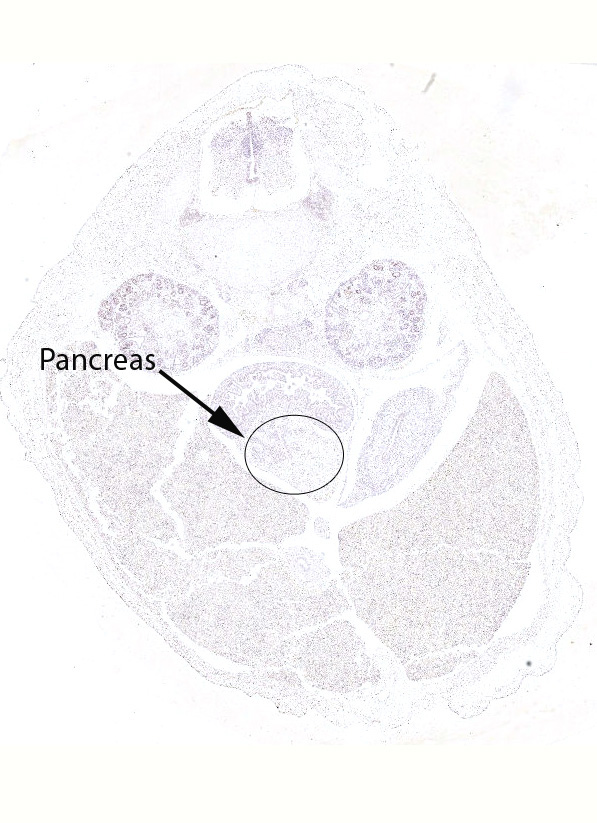 Gene expression in the human fetal pancreas