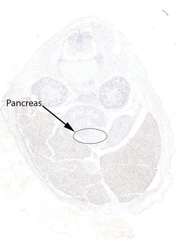 Gene expression in the human fetal pancreas