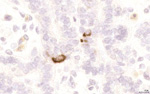 Gene expression in the human fetal pancreas