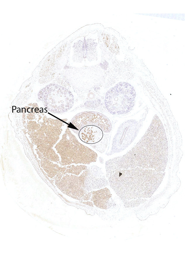Gene expression in the human fetal pancreas