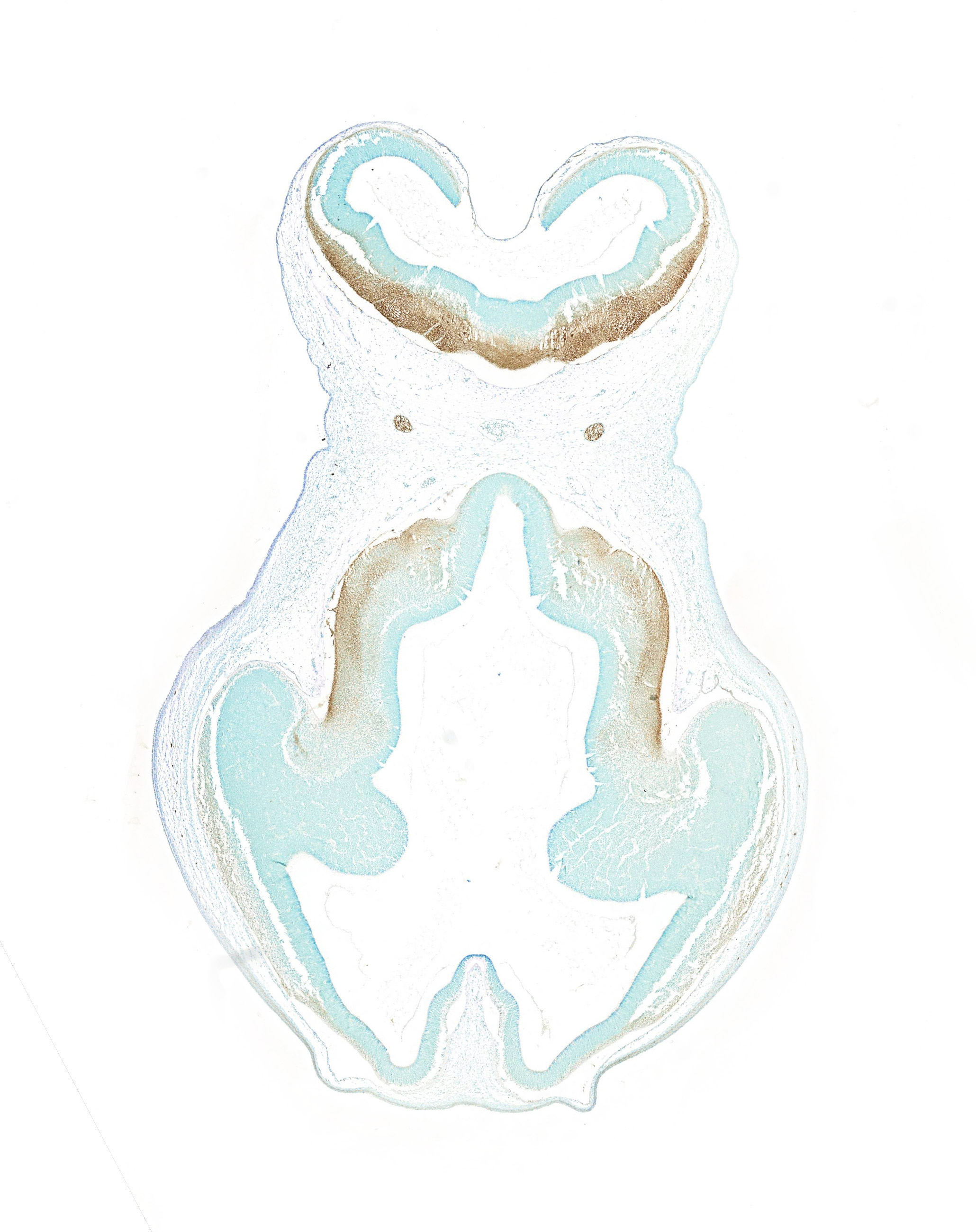 Gene expression in the human embryonic brain