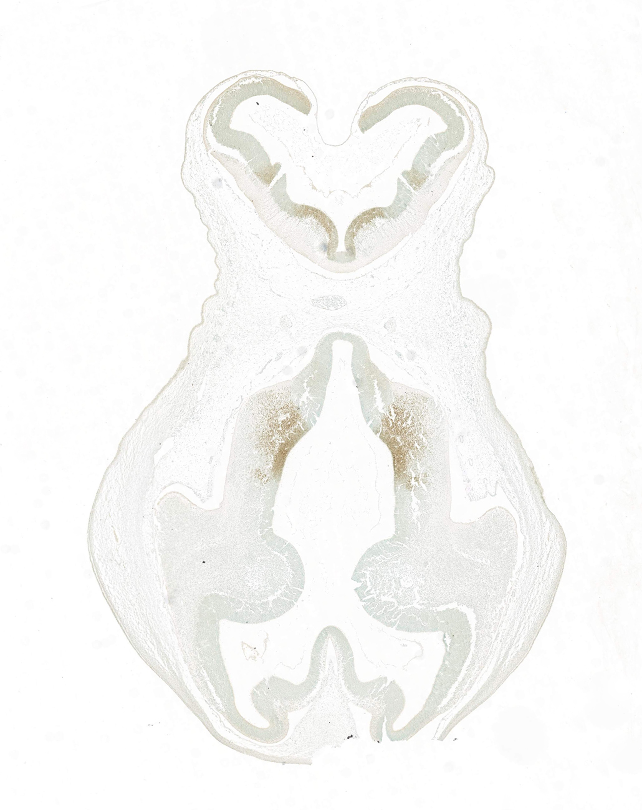 Gene expression in the human embryonic brain