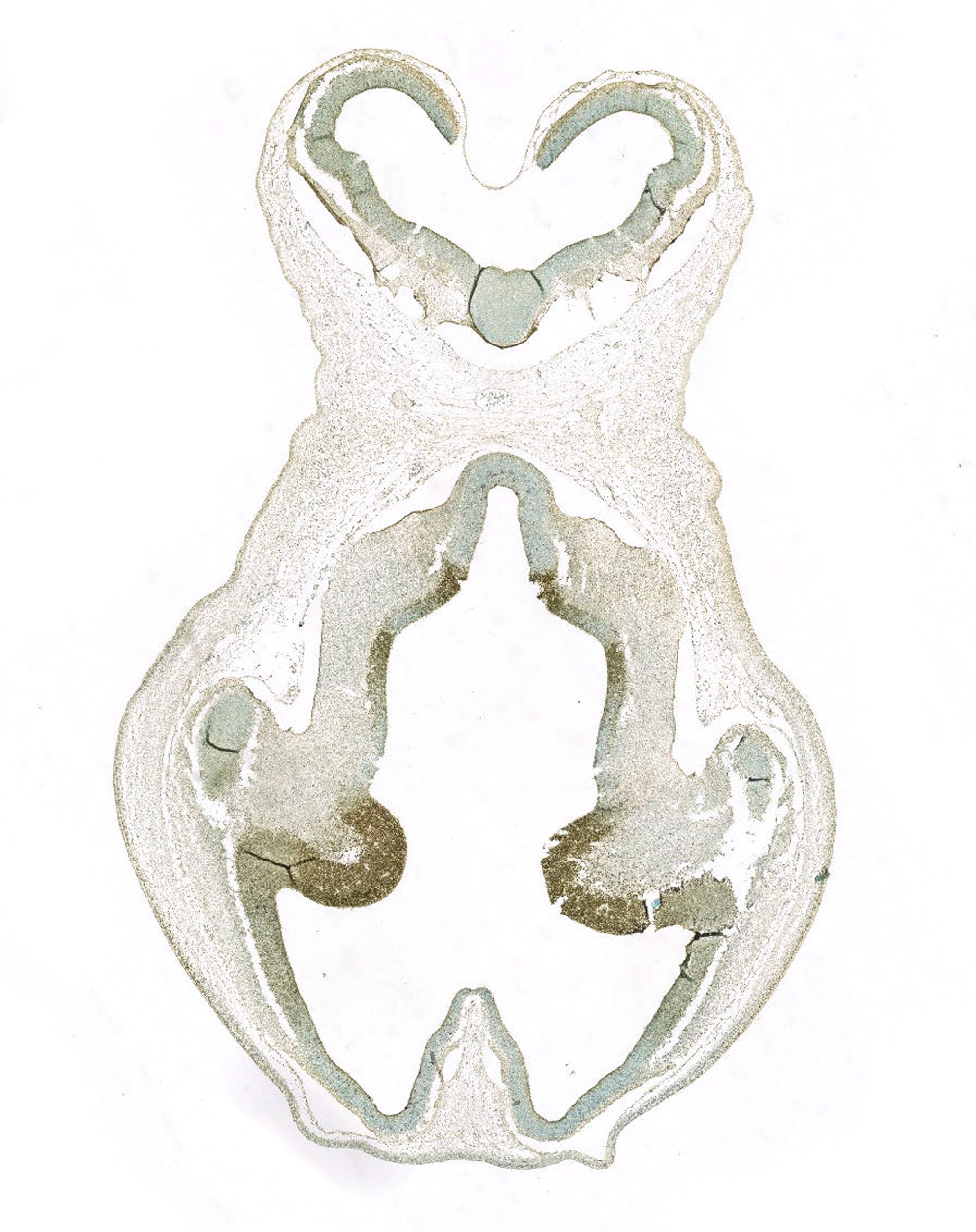 Gene expression in the human embryonic brain