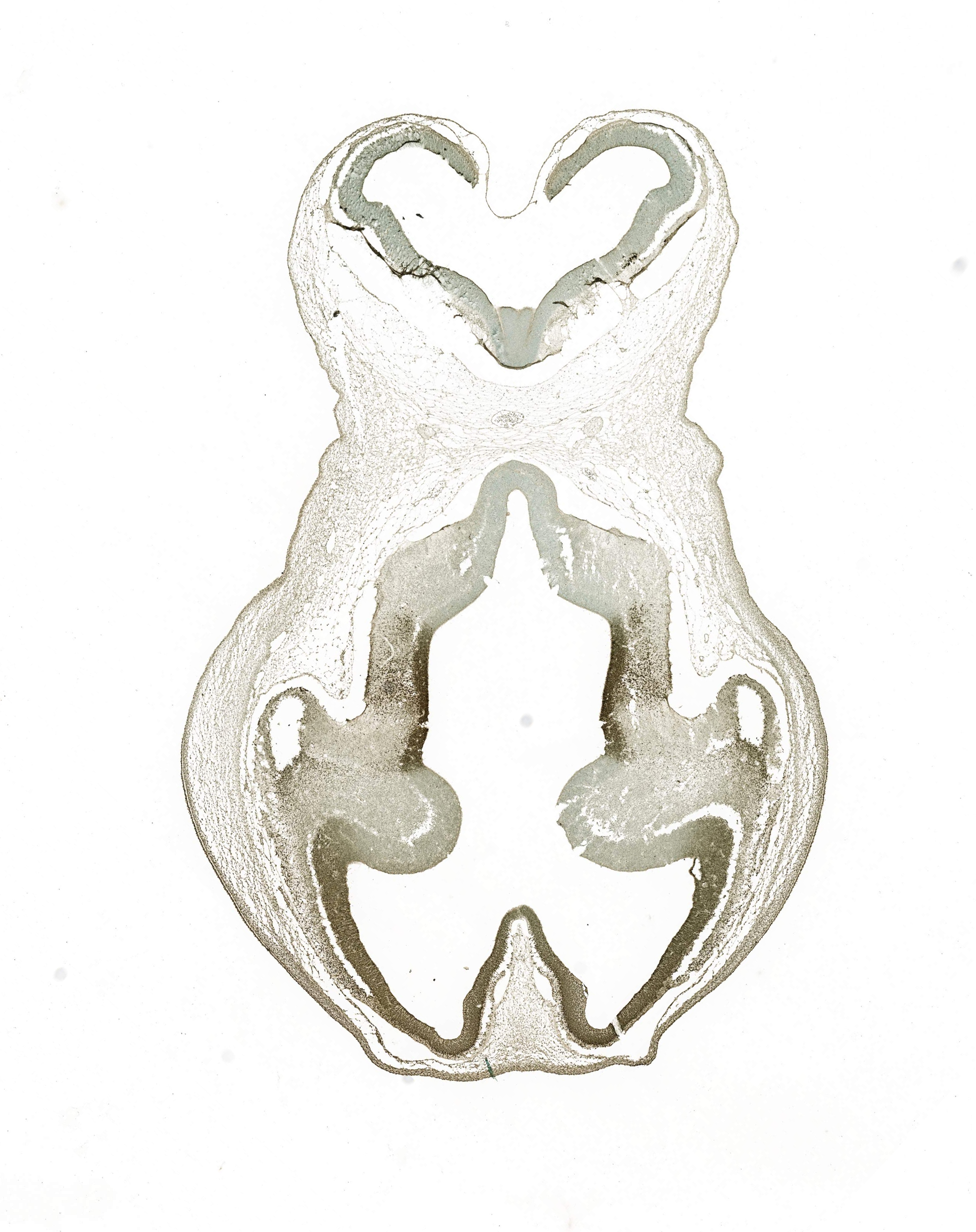 Gene expression in the human embryonic brain