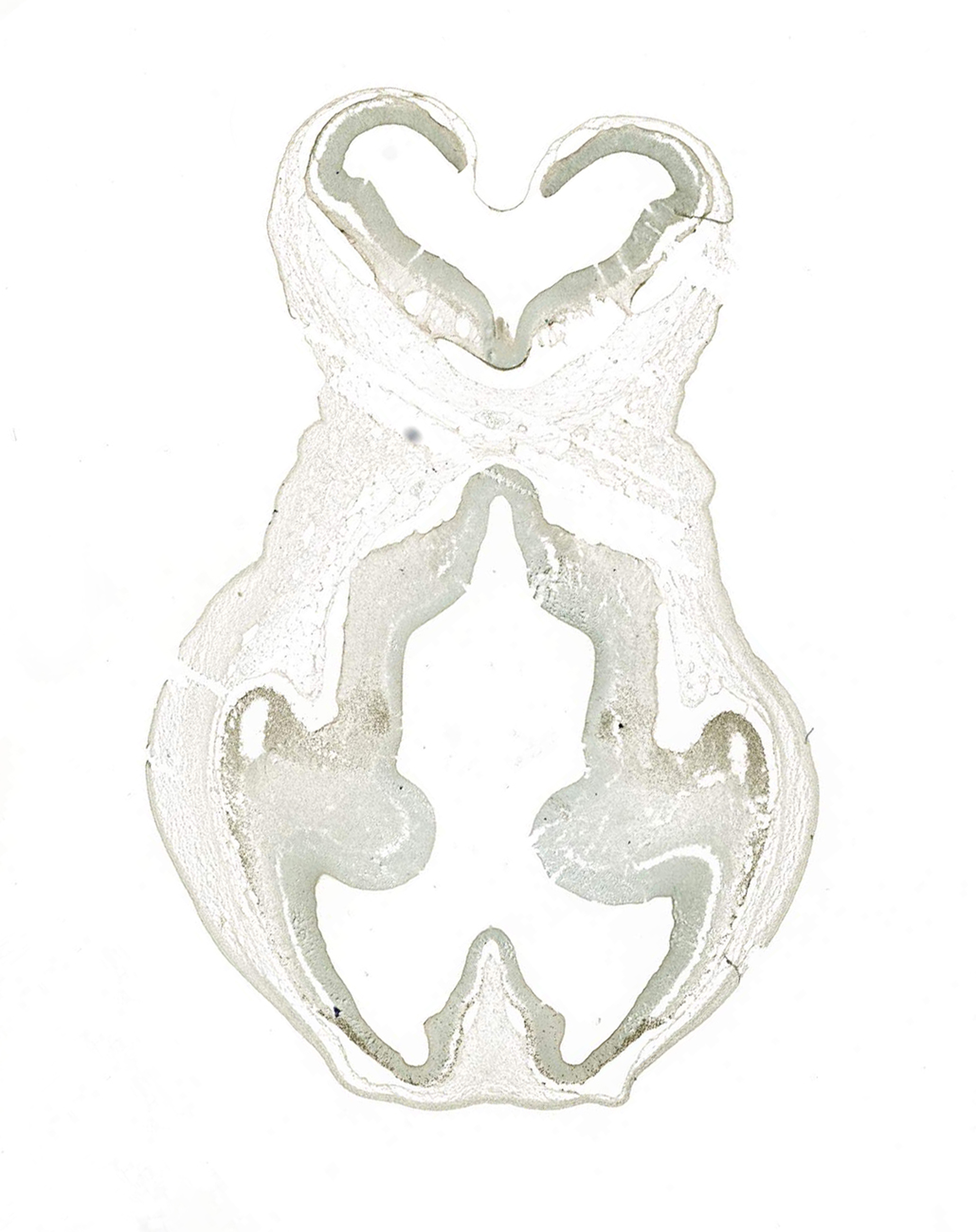 Gene expression in the human embryonic brain