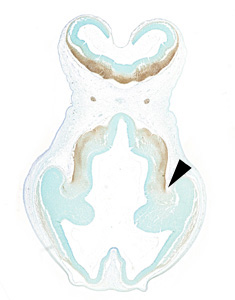 Gene expression in the human embryonic brain