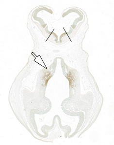 Gene expression in the human embryonic brain
