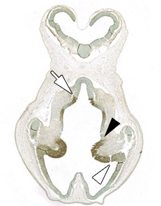 Gene expression in the human embryonic brain