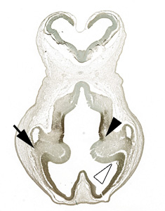 Gene expression in the human embryonic brain