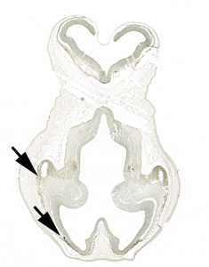 Gene expression in the human embryonic brain