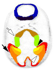 Gene expression in the human embryonic brain