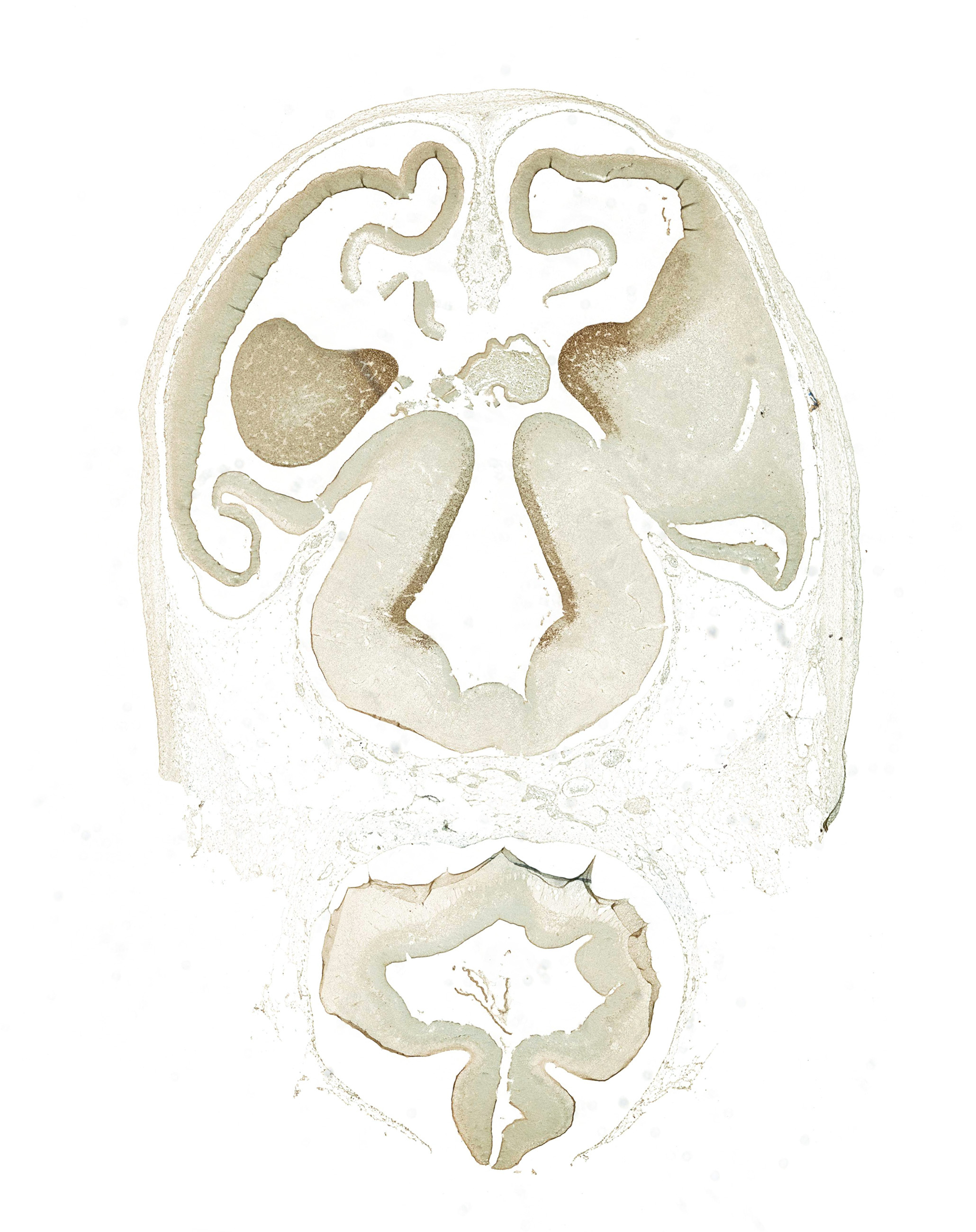 Gene expression in the human embryonic brain