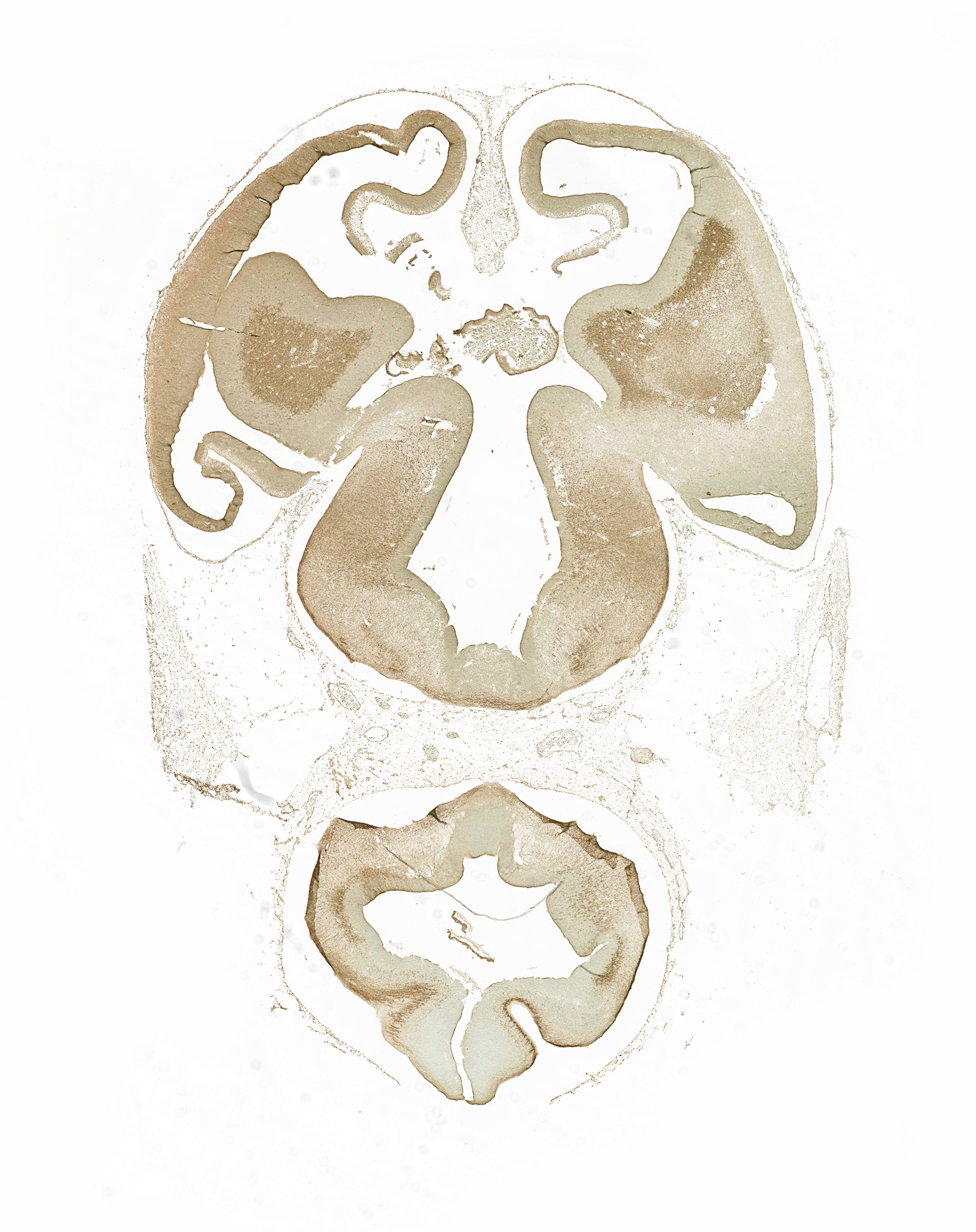 Gene expression in the human embryonic brain