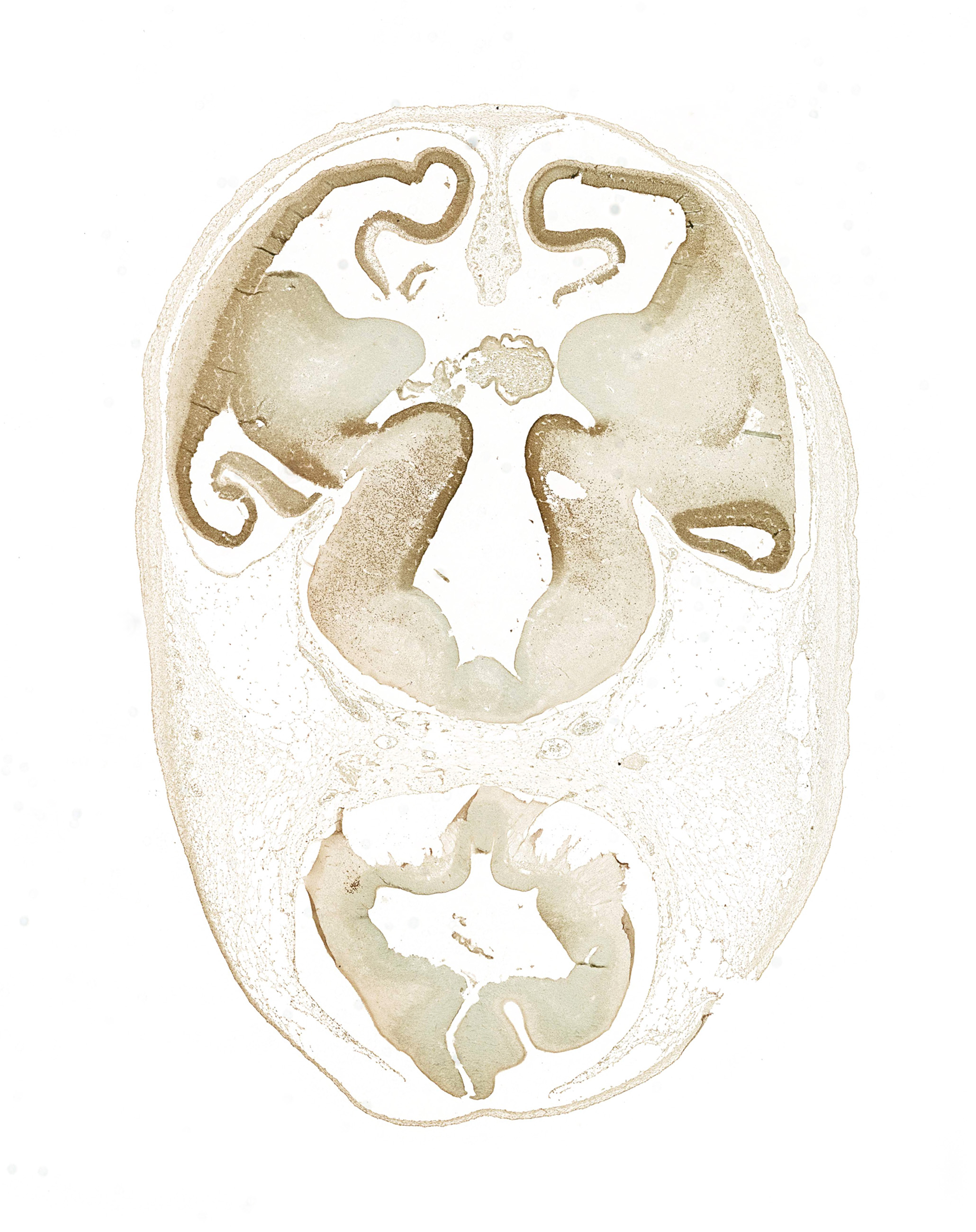 Gene expression in the human embryonic brain