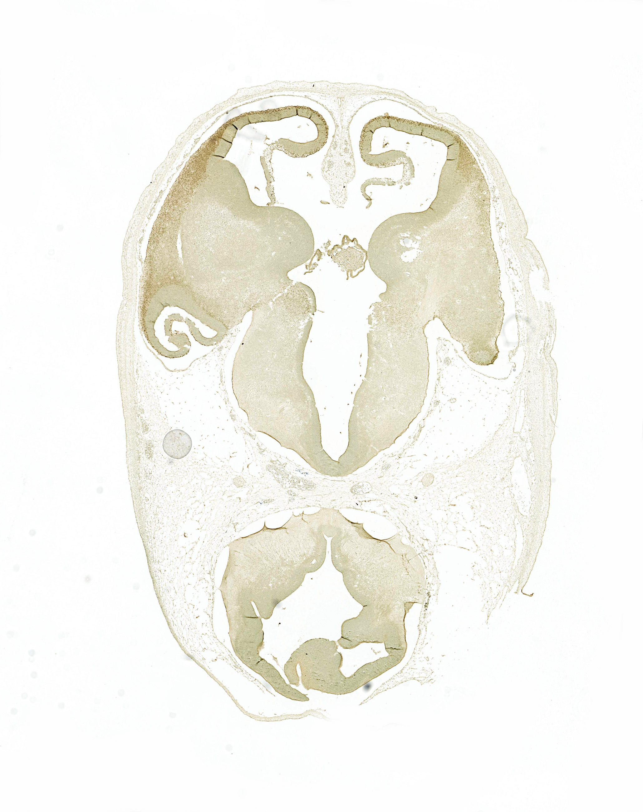 Gene expression in the human embryonic brain