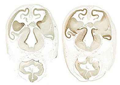 Gene expression in the human embryonic brain