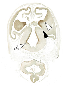 gene expression in the human embryonic brain